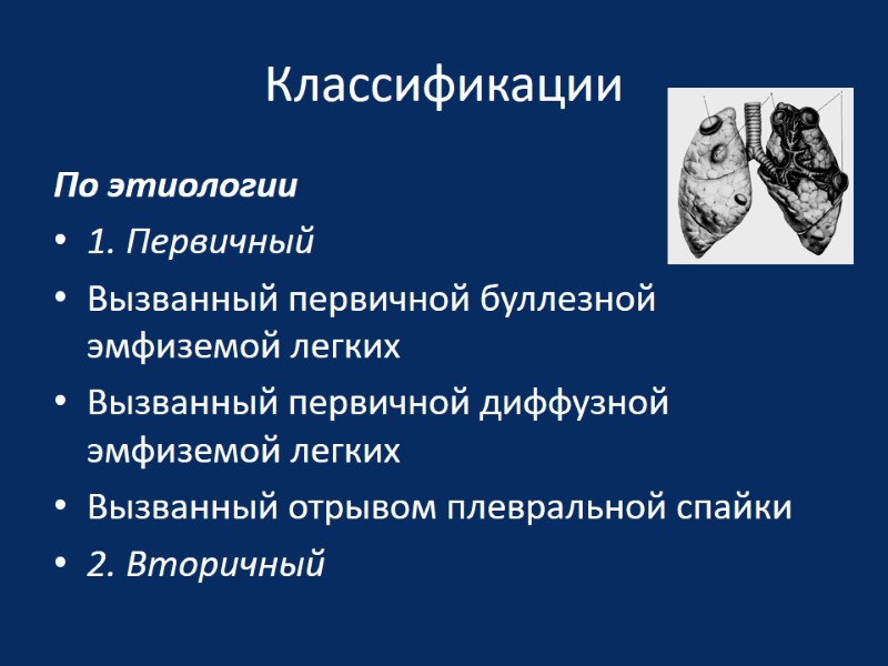 Классификации По этиологии 1. Первичный  Вызванный первичной буллезной эмфиземой легких Вызванный первичной диффузной